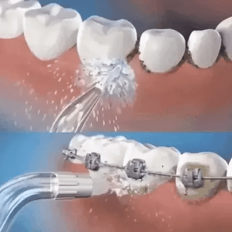 Irrigador Oral Bucal Recarregável Portátil - PowerJet